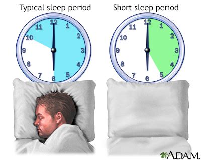 Am I a naturally short sleeper?
