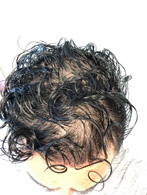 Am I balding or is my hair just curly?