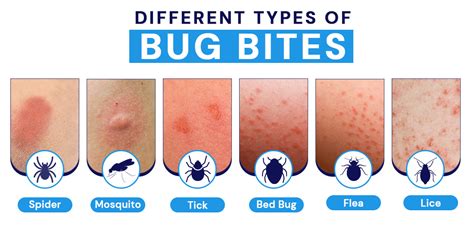 Am I immune to bee stings?