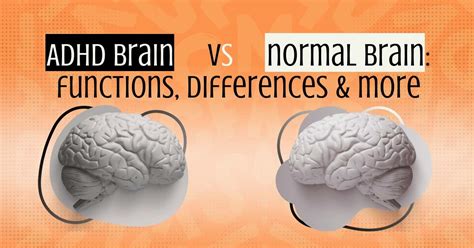 Are ADHD kids smarter than normal kids?