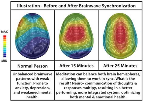 Are Beats good for your brain?