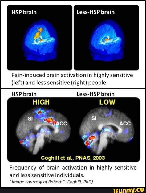 Are HSP brains different?