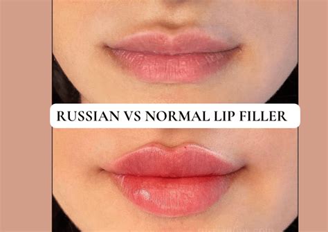 Are Russian lips less painful?