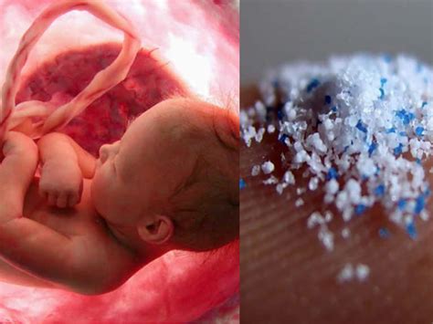 Are babies born with microplastics?
