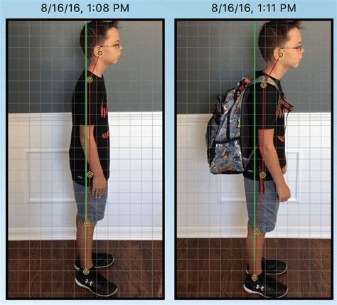 Are backpacks unhealthy?