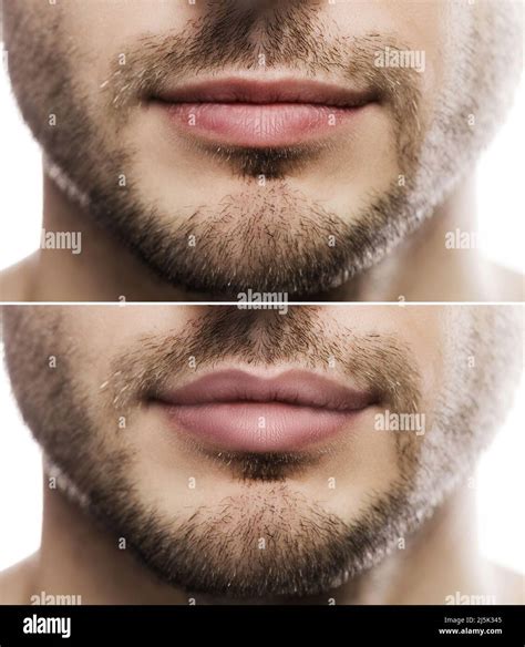 Are big lips unattractive on a guy?