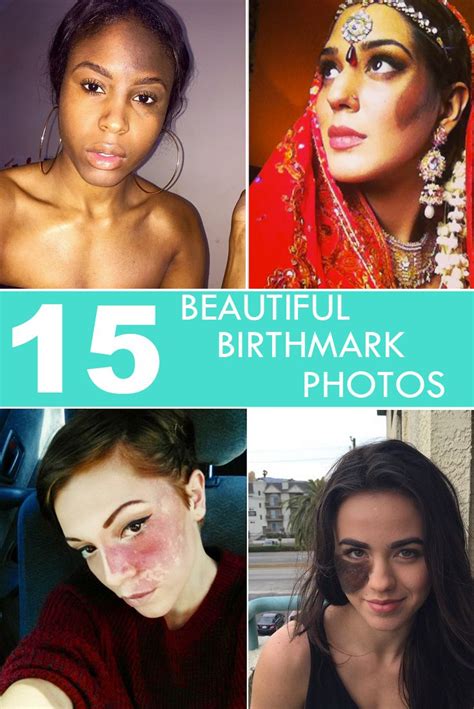 Are birthmarks considered beautiful?