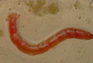 Are bloodworms painful?