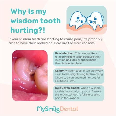 Are bottom wisdom teeth more painful?