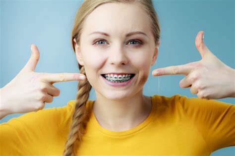 Are braces a good idea?