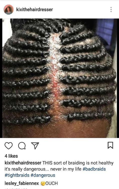 Are braids damaging?