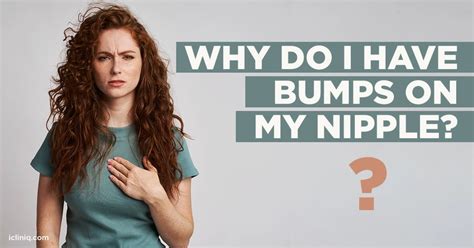 Are bumps on nipples normal?