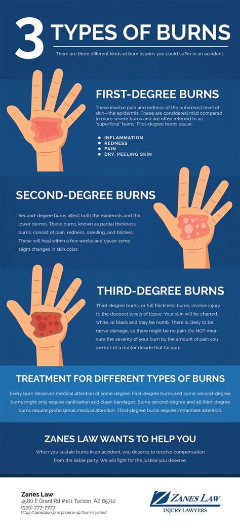 Are burns the worst type of pain?