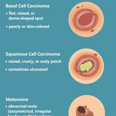 Are cancers very sensitive?