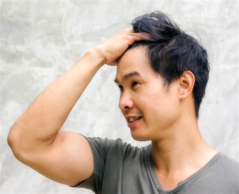 Are certain ethnicities more prone to hair loss?