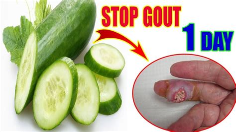 Are cucumbers bad for gout?