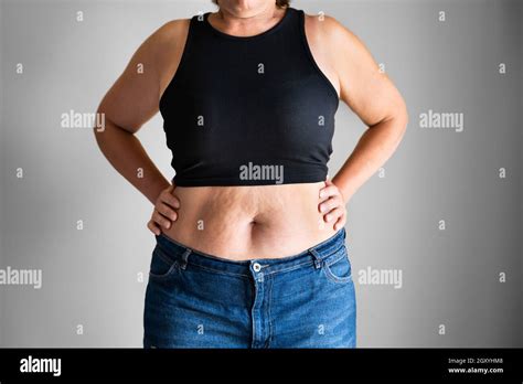 Are fat peoples belly buttons deeper?