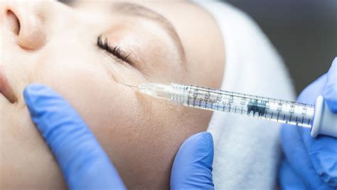 Are fillers safe for autoimmune?