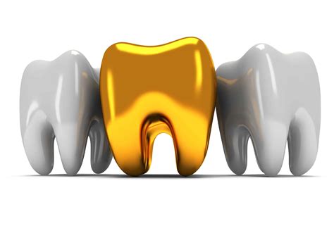 Are gold teeth safe?