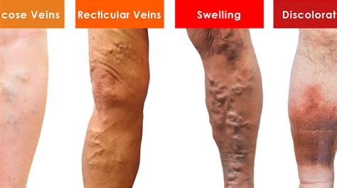 Are green veins good or bad?