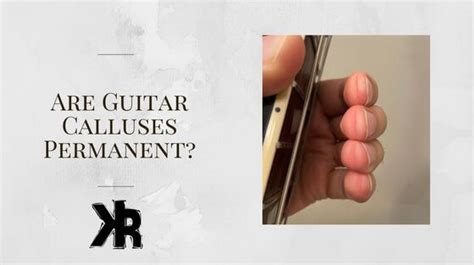 Are guitar calluses permanent?
