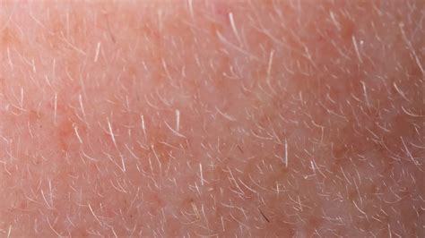 Are hair mites harmful?