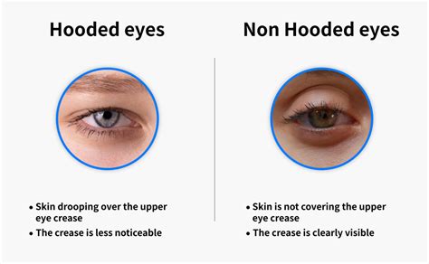 Are hooded eyelids normal?