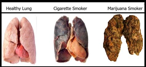 Are joints better for your lungs than cigarettes?