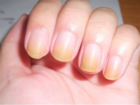 Are nail polish stains permanent?
