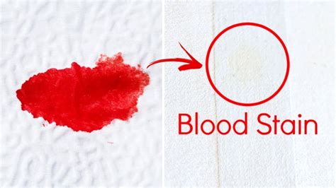 Are old blood stains permanent?