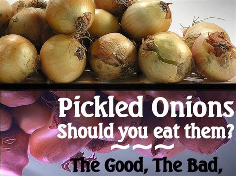 Are onions bad for gout?