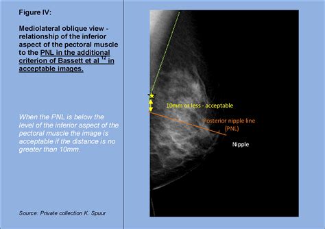 Are oval nipples normal?