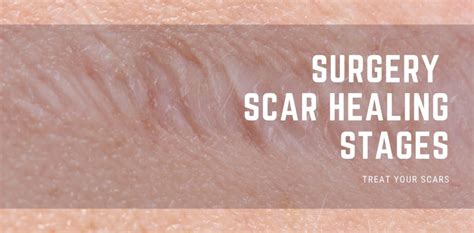 Are scars dark at first?