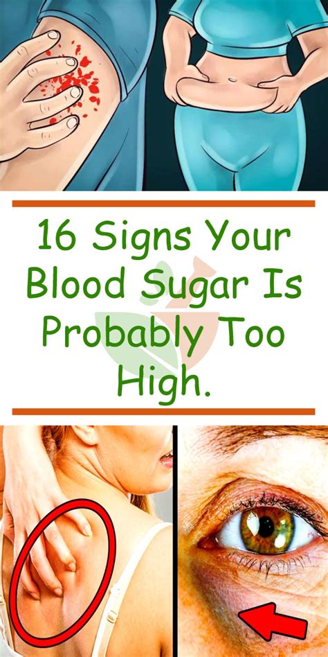 Are skin tags caused by too much sugar?