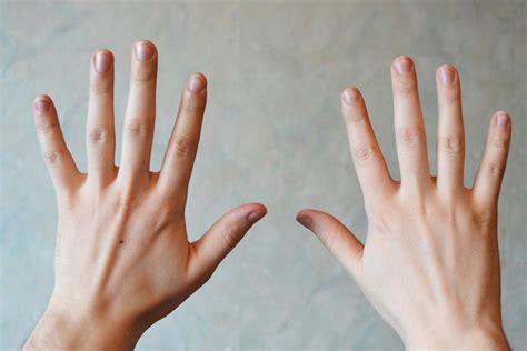 Are skinny fingers normal?