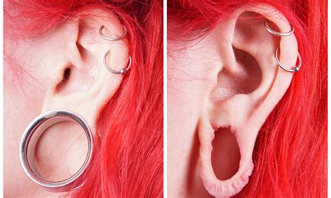 Are stretched ears safe?