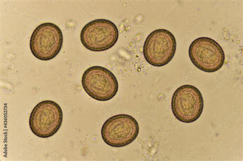 Are tapeworm eggs hard or soft?