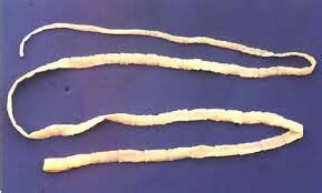 Are tapeworms edible?