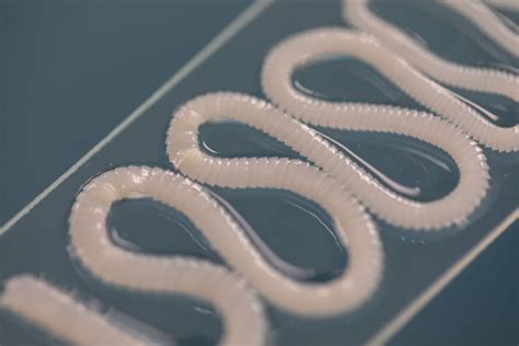 Are tapeworms life threatening?