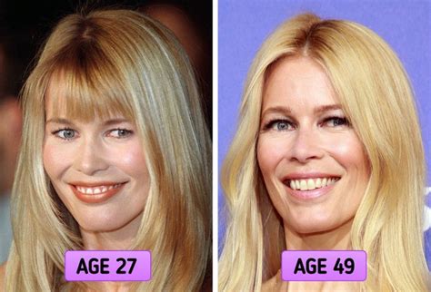 Are there any celebrities who don't use Botox?