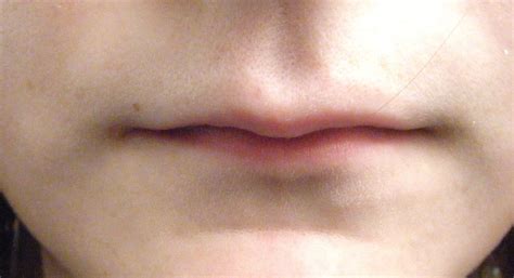 Are thin lips unattractive?