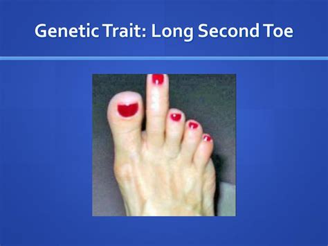 Are toes genetic?