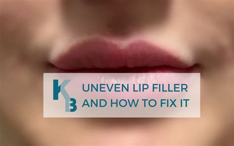 Are uneven lips unattractive?