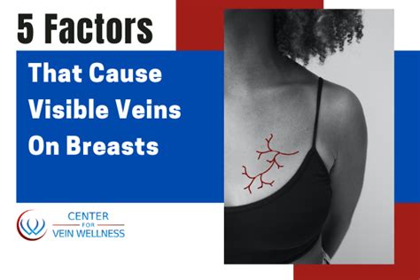 Are veins on breasts unattractive?