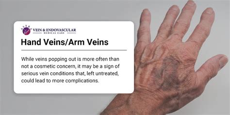 Are visible veins on hands good or bad?