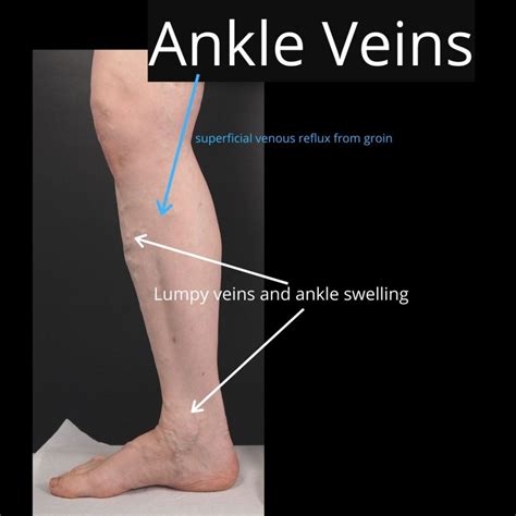 Are visible veins unattractive?