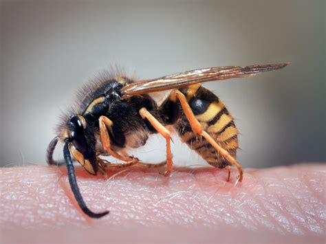 Are wasp stings toxic?