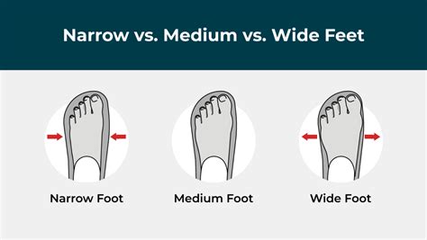 Are wide feet rare?