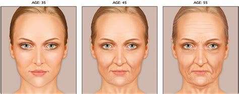 At what age do wrinkles appear?