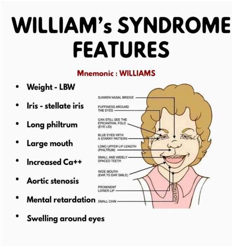 At what age is Williams syndrome diagnosed?